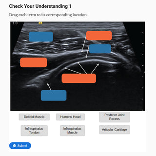 Point-of-Care Ultrasound with Vascular Access (Online-Only Didactic Modules)